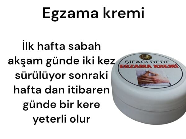 EGZAMA KREMİ