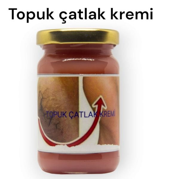 Topuk Çatlak Kremi
