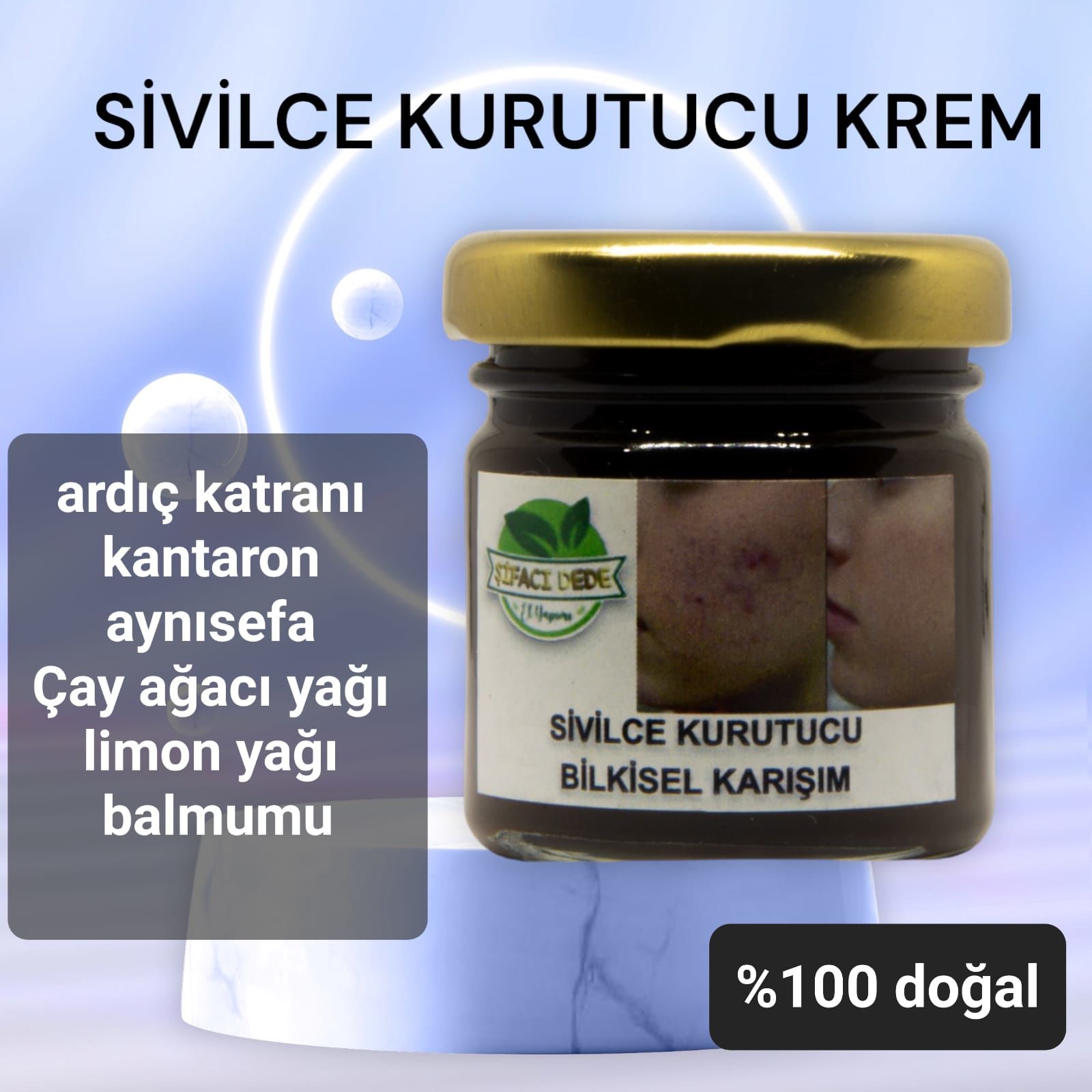 Sivilce Kurutucu Krem